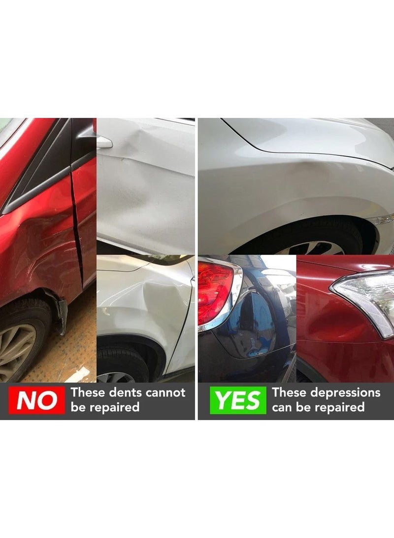 Car dent repair vacuum tool – for easy and safe dent removal without a technician and at a lower cost - Image 4