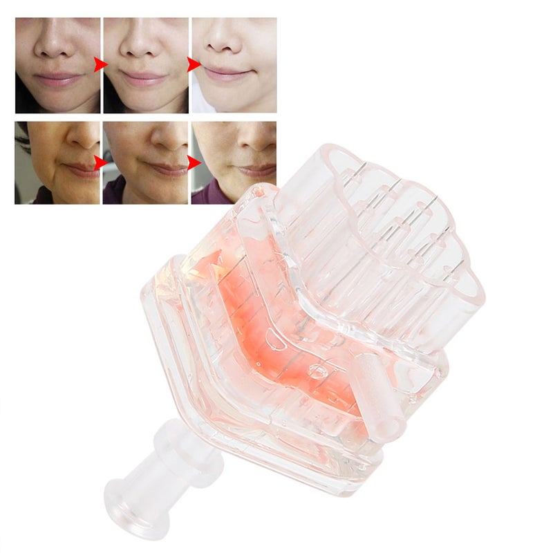 9-Pins Disposable ABS Needle Negative Pressure Replacement Kits for Injection Gun - Image 4