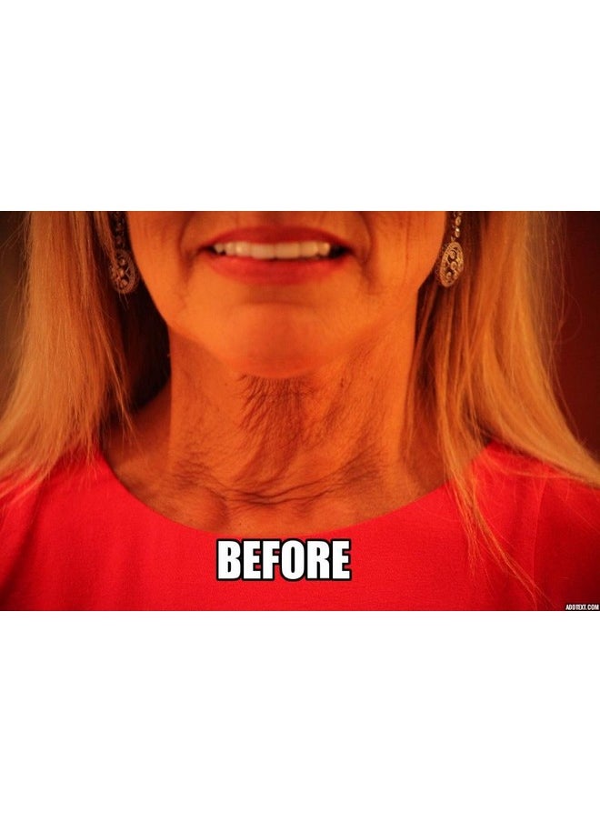 NeckTITE Magic The Instant Neck Lift  - Image 2