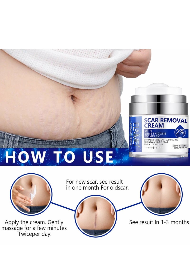 Elaimei Scar Removal Cream with 2% Dimethicone Complex Quick Effect for New and Old Pregnancy Scald and Operation Scar to Repair Damage Skin and Nourish and Brighten Skin 50ML  - Image 4