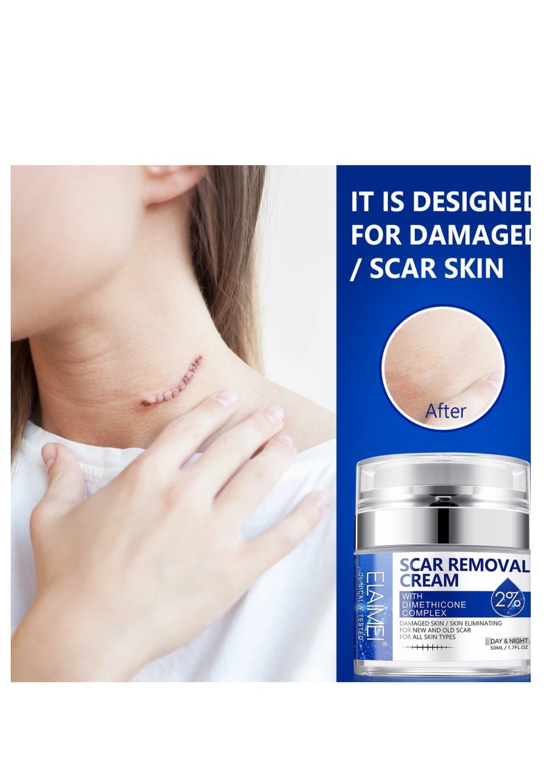 Elaimei Scar Removal Cream with 2% Dimethicone Complex Quick Effect for New and Old Pregnancy Scald and Operation Scar to Repair Damage Skin and Nourish and Brighten Skin 50ML  - Image 5