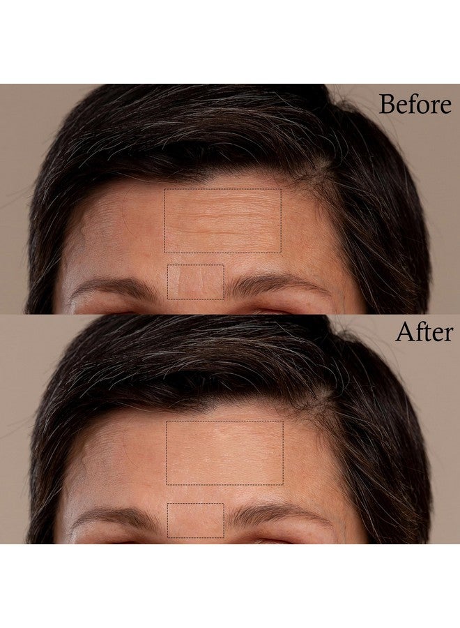 innerest Face Eye Wrinkles Forehead Wrinkle Patches For Face Overnight 72 Pcs - Image 2