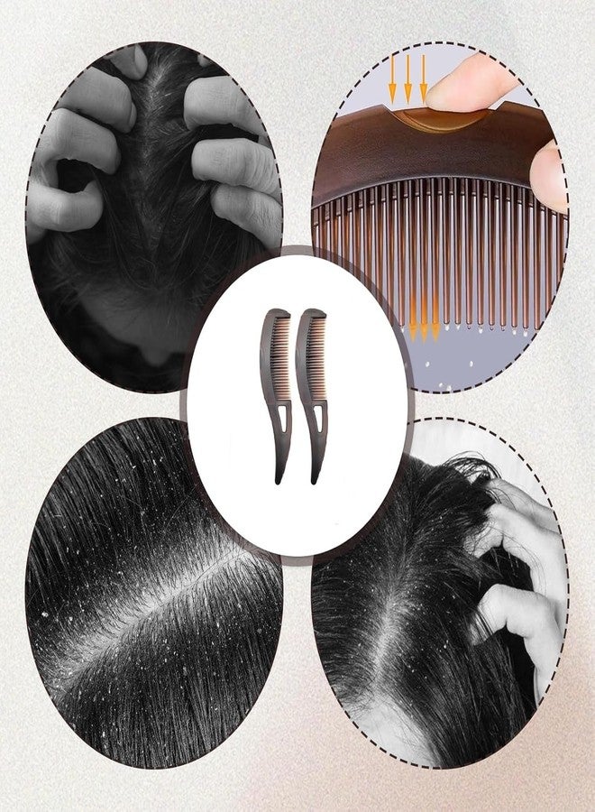 VPGS Revolutionary design of dandruff comb, beauty comb, healthier scalp, better hair quality for women and men to remove dandruff and dirt (Medium, Count, 1) - Image 3