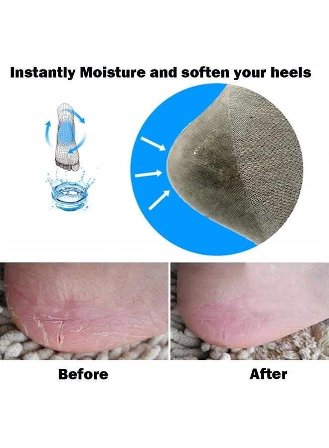 Codream Vented Moisturizing Socks Lotion Gel for Dry Cracked Heels, Spa Gel Socks Humectant Moisturizer Heel Balm Foot Treatment Care Heel Softener Compression 2 Pairs - Image 5
