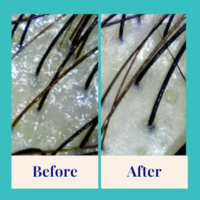 The Powder Shampoo - Powder Shampoo Aluminum Bottle Purifying & Regulating Shampoo (Thyme & Peppermint) - 2.47 oz - Image 3