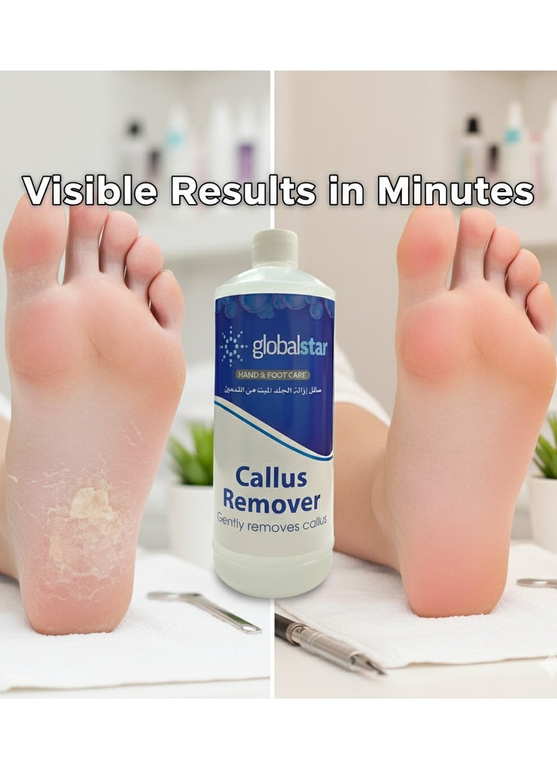 Globalstar 1000ml Callus Remover – Simplify Nail Care by Removing Dead Skin and Shaping Cuticles - Image 5