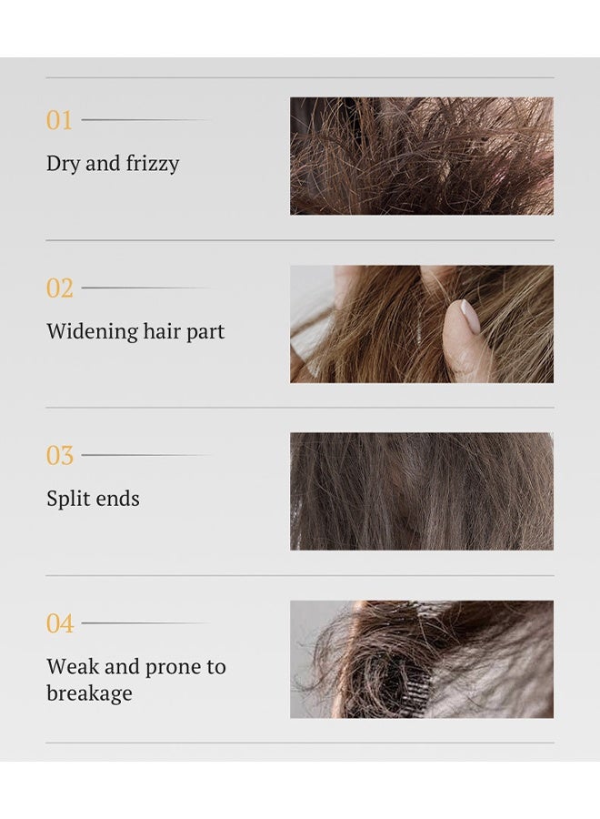 Kormesic 5% Minoxidil With Biotin Conditioner 300ml, Thickening & Volumizing Conditioner, Strengthen Hair Promote Hairs Regrowth Reduce Hairs Loss Removes Dandruff & Relieve Itching - Image 4