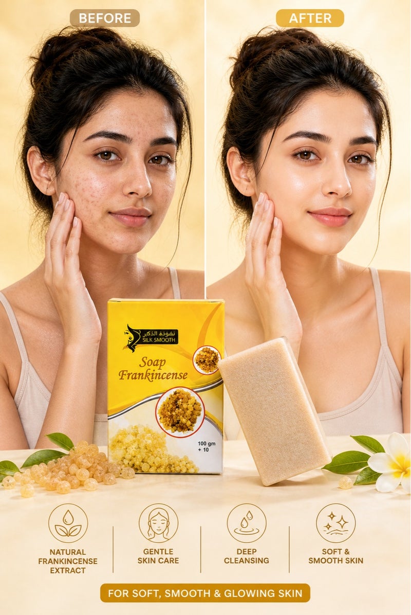SILK SMOOTH Frankincense Soap 100g – Natural Anti-Aging & Deep Cleansing Bar – Helps Brighten Skin, Reduce Blemishes & Improve Skin Texture – Face & Body Soap - Image 4