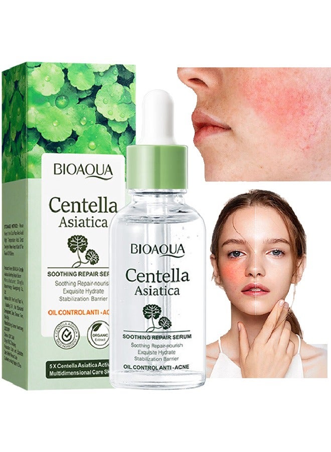 BIOAOUA Centella Asiatica Soothing Repair Serum - Nourish Oil Control Anti-Acne Face Skin Care - Image 1