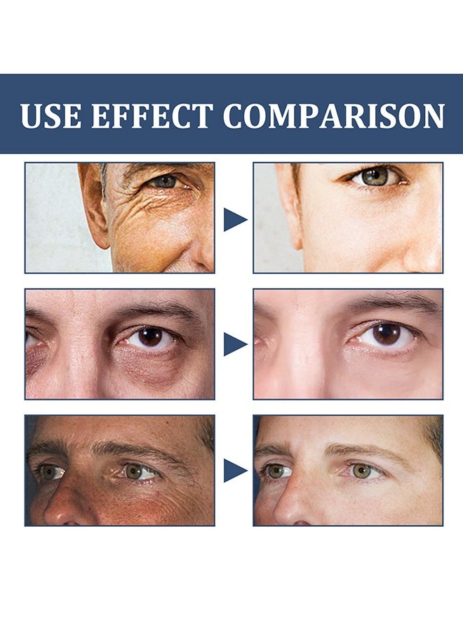 East Moon - Face Cream, 6 in 1 Men's Face Moisturizer , Men's Eye Bag Treatment & Face Lotion, Men's Anti-Aging, Anti-Wrinkle & Dark Spots Men's Face Cream-50ml - Image 1
