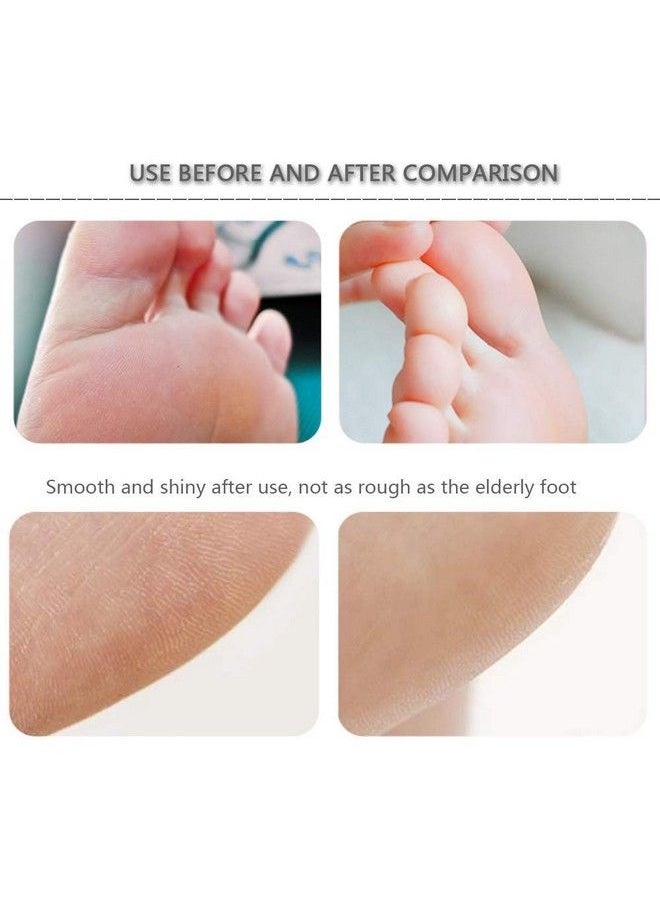 advancedestore - Foot File Rasp Callus Remover Professional Pedicure File Foot Scrubber Dry Skin Care Tool For Foot Dead Skin Corn Callus Remover(Pack Of 1) - Image 1