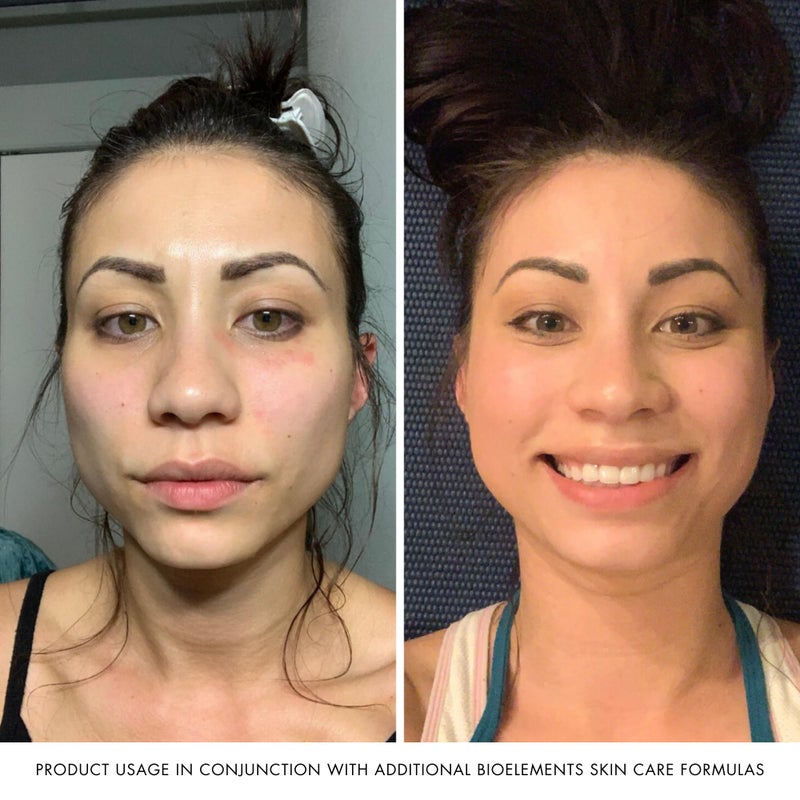 Bioelements Flash Foam Cleanser - 6.5 fl oz - Exfoliating Foam Cleanser for Oily, Combination & Dry Skin - Vegan, Gluten Free - Image 5