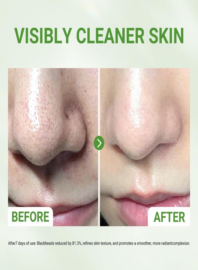 Dr.Leo 3X Acid Clay Mask, Pore Minimizing & Oil Control Face Mask, 3.53oz - Image 3