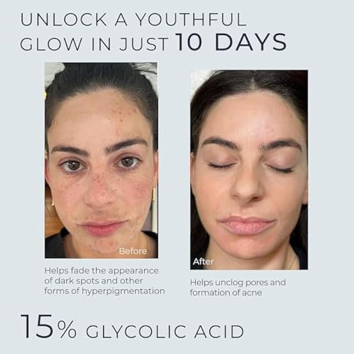 InstaSkincare Glycolic Acid Serum for Face 15% Strength - Extra Large Size (8Oz) - Advanced Formula for Enhancing Skin Radiance, Texture Improvement, Addressing Uneven Tone & Fine Lines - Image 2