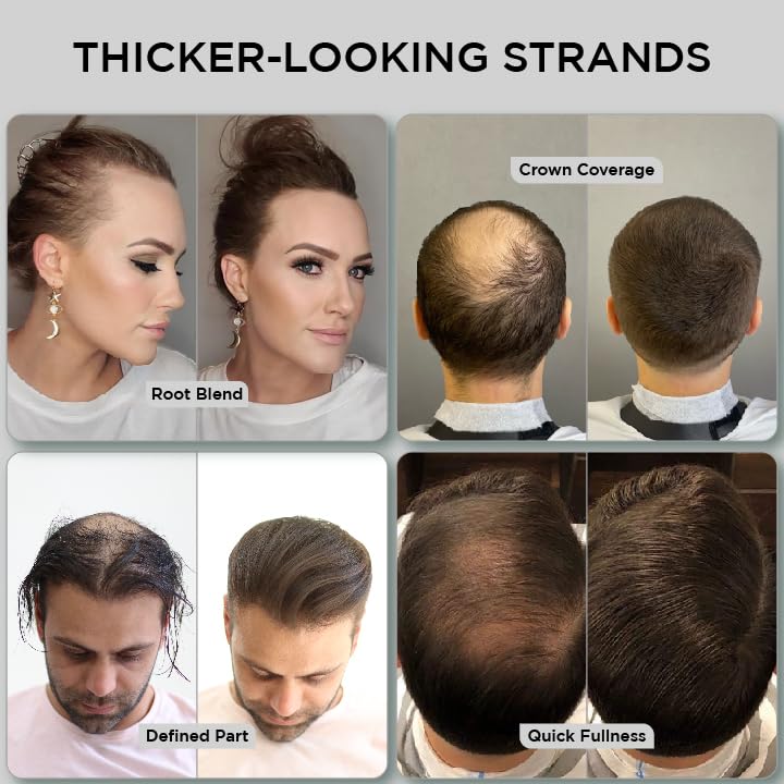 Thick Fiber ألياف سميكة لألياف الشعر الرقيق بقع صلعاء بني داكن عبوة من 2 زجاجة 25 جرام تخفي تساقط الشعر في ثوانٍ للنساء والرجال - Image 3