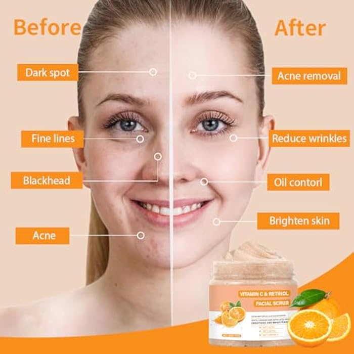IREV Vitamin C Face Scrub, Exfoliating Facial Wash with Retinol, Facial Scrub,Facial Exfoliating Scrub, Facial Scrubs for Women,Deep Cleansing Face Wash Cleanser for Women Men - Image 2