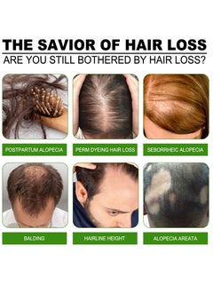 SOUTH MOON Anti-Hair Fall Growth Treatment Essence  - Image 5