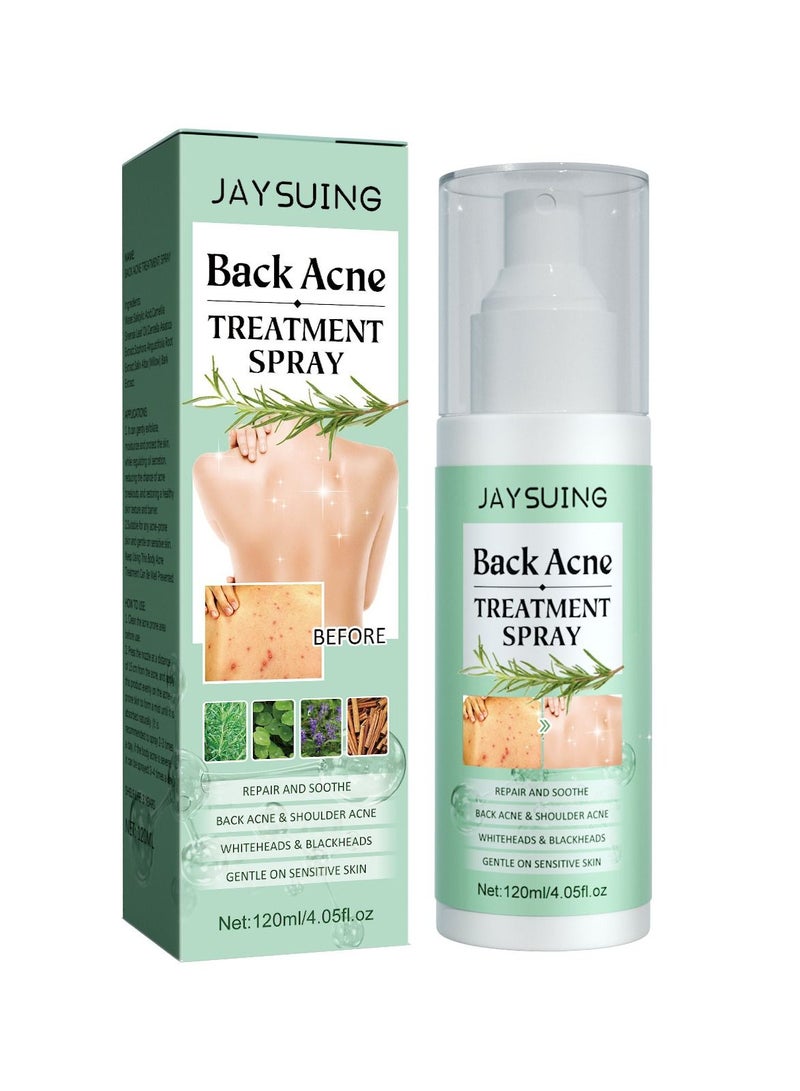 Jaysuing Back Acne treatment Spray Repair And Soothe Back Acne & Shoulder Acne Whiteheads & Blackheads Gentle On Sensitive Skin 120ml - Image 1