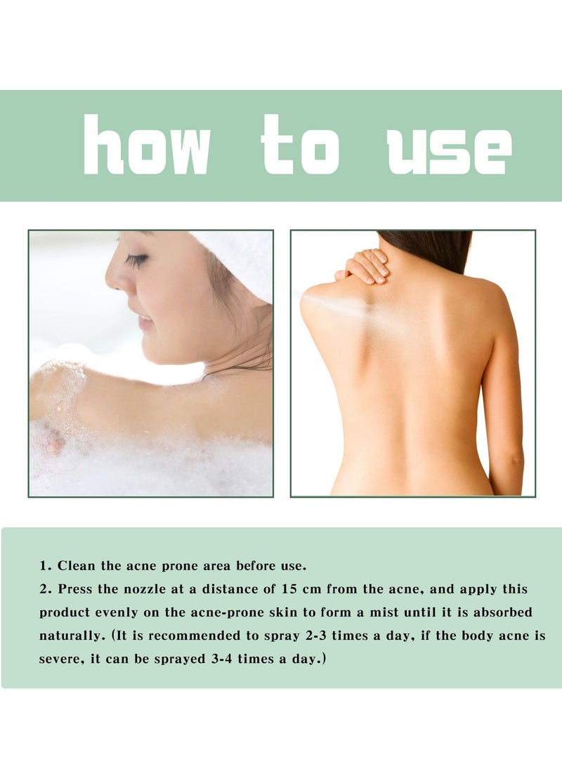Jaysuing Back Acne treatment Spray Repair And Soothe Back Acne & Shoulder Acne Whiteheads & Blackheads Gentle On Sensitive Skin 120ml - Image 5