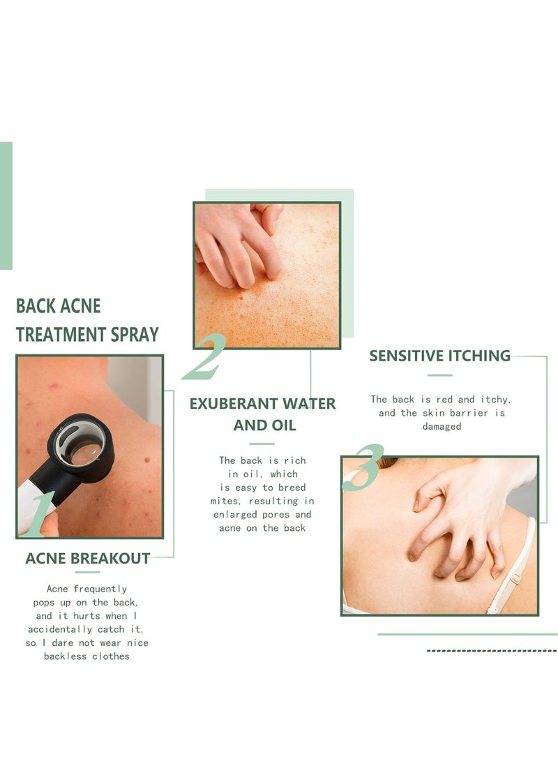 Jaysuing Back Acne Lighten Acne Marks Repair Back Shoulder Acne Skin Care spray 120ml - Image 3