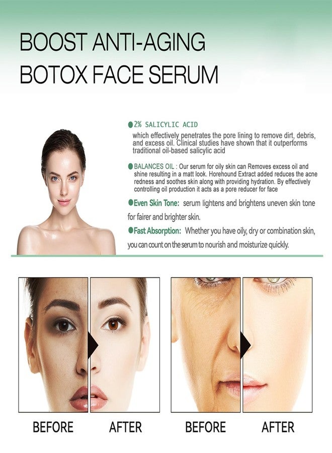 Grospe 2% Salicylic Acid Serum,Salicylic Acid Serum for Acne Blackhead & Spot Pore Minimizer Acne Reduces Excess Oil Active Skin Repair For Acne Prone Sensitive Skin Care 1 Fl Oz - Image 2