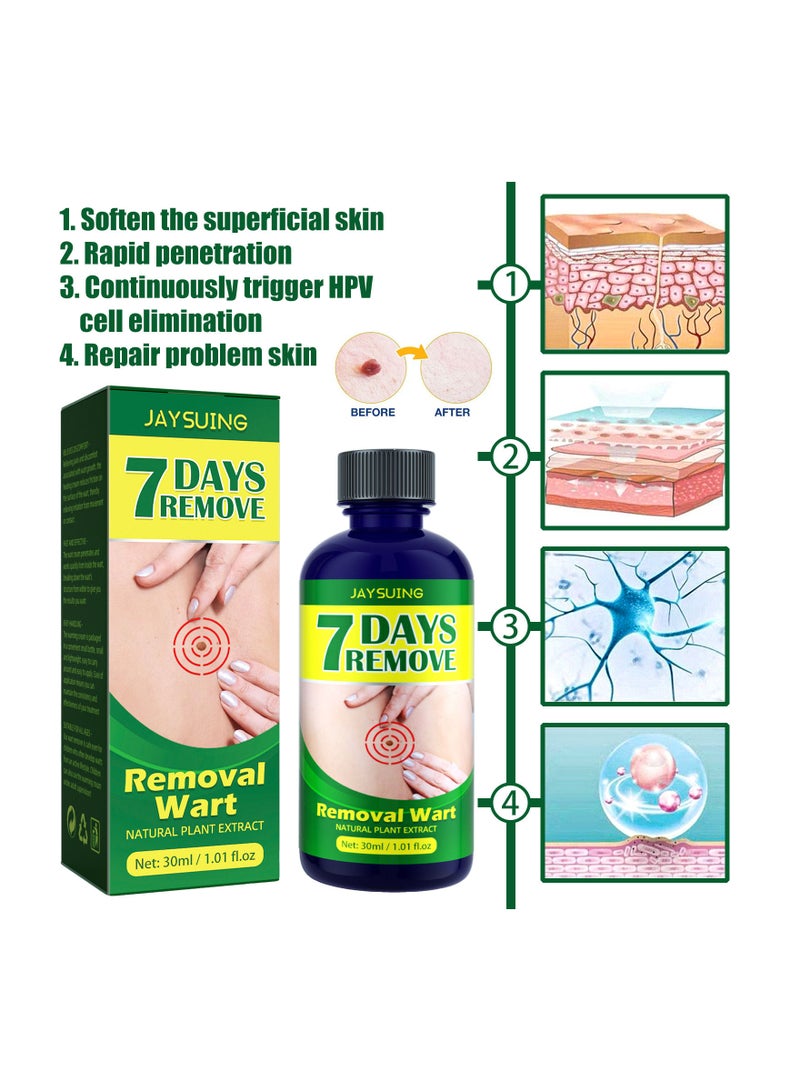 Jaysuing Natural Source Wart Removal  - Image 3