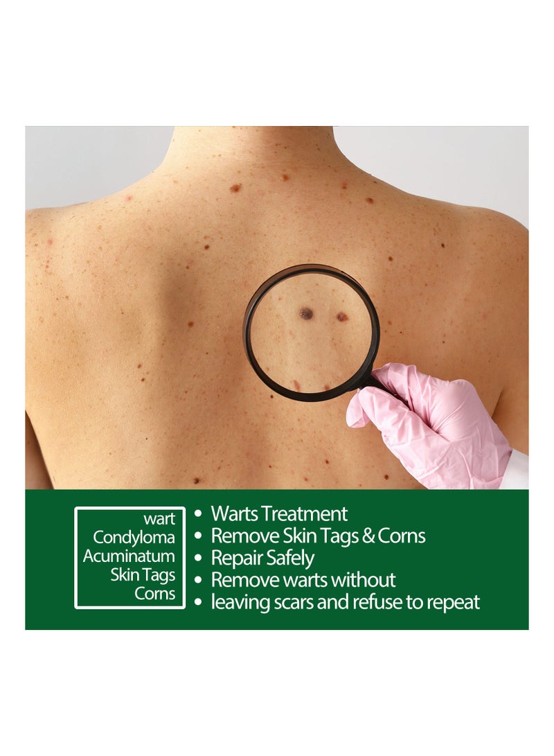 Jaysuing Natural Source Wart Removal  - Image 4