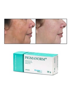 Pigmanorm Cream  For Skin lightening and Whitening