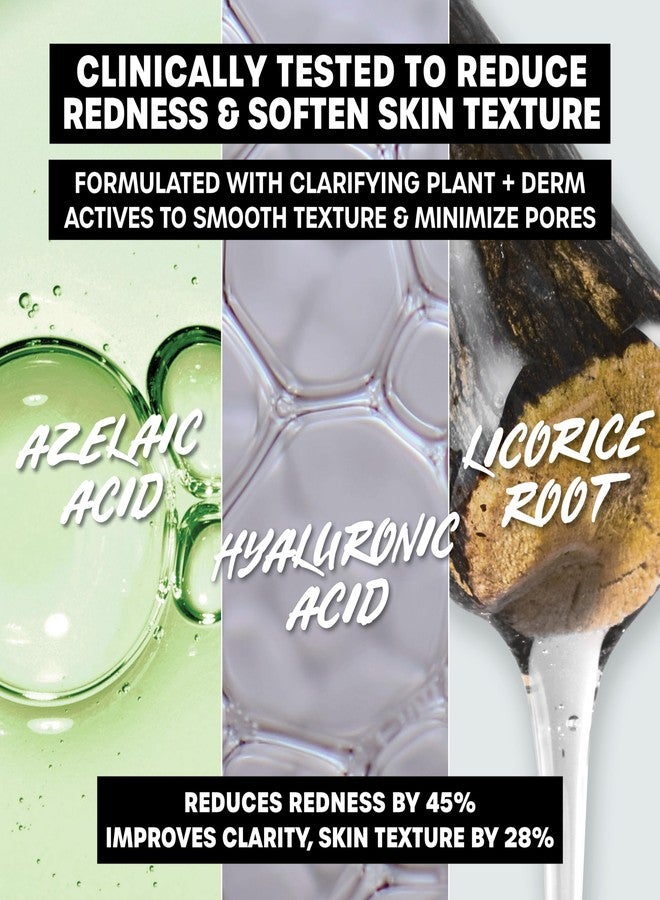 THAYERS Let's Be Clear Water Face Cream, Moisturizer with Azelaic Acid and Hyaluronic Acid, Skin Care for Combination to Oily Skin, 2.5 Oz - Image 4