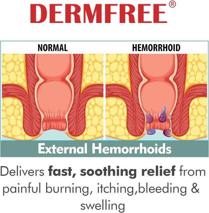 DERMFREE Hemorrhoid Ointment Care Instantly Relieves Swelling Pain Itching Burning and External DiscomfortHelps to Protect Irritated Tissue15Oz 15 Oz Pack of 3 - Image 3