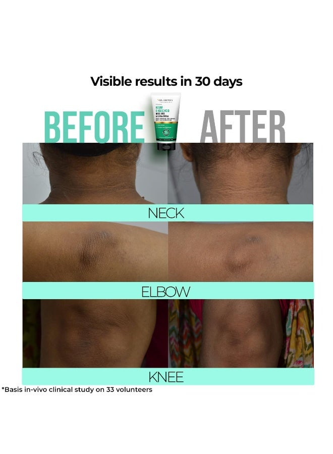 Dr. Sheth's Kesar & Kojic Acid Neck, Knee & Elbow Cream | Clinically Tested | Helps To Reduce Pigmentation | 10% AHAs+2% Kojic Acid+Urea | For Dark Neck, Ankles, Knuckles, Knees, Thighs & Elbows | 50g - Image 4