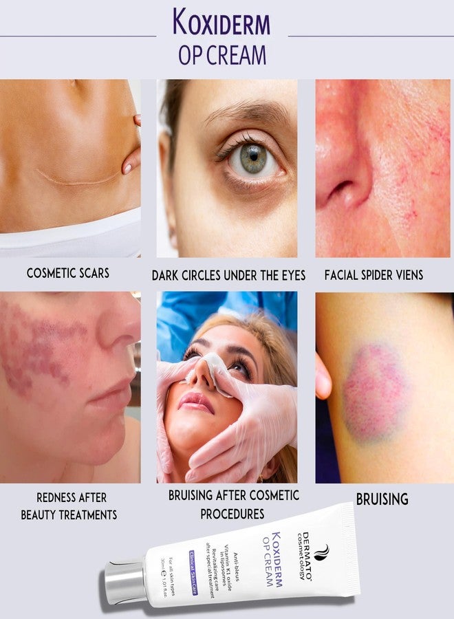 Anacis Vitamin K1 Oxiderm Cream Minimizing Appearance of Old and New Scars, Dark Eye Circles, Bruises, Varicose Veins, Purpura and Redness 1.01Oz - Image 2