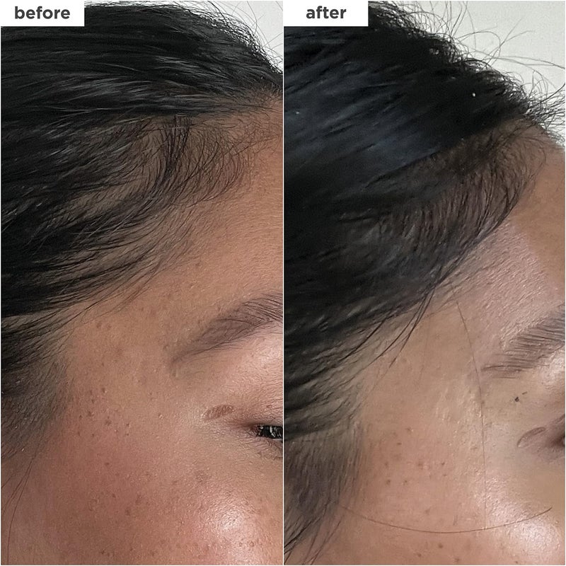 Briogeo Destined For Density MegaStrength+ Caffeine + Biotin Peptide Density Serum, Increases Hair Thickness and Volume, Fast-Absorbing & Non-Greasy, Fragrance-Free, Vegan, Cruelty-Free, 1.5 fl oz - Image 4