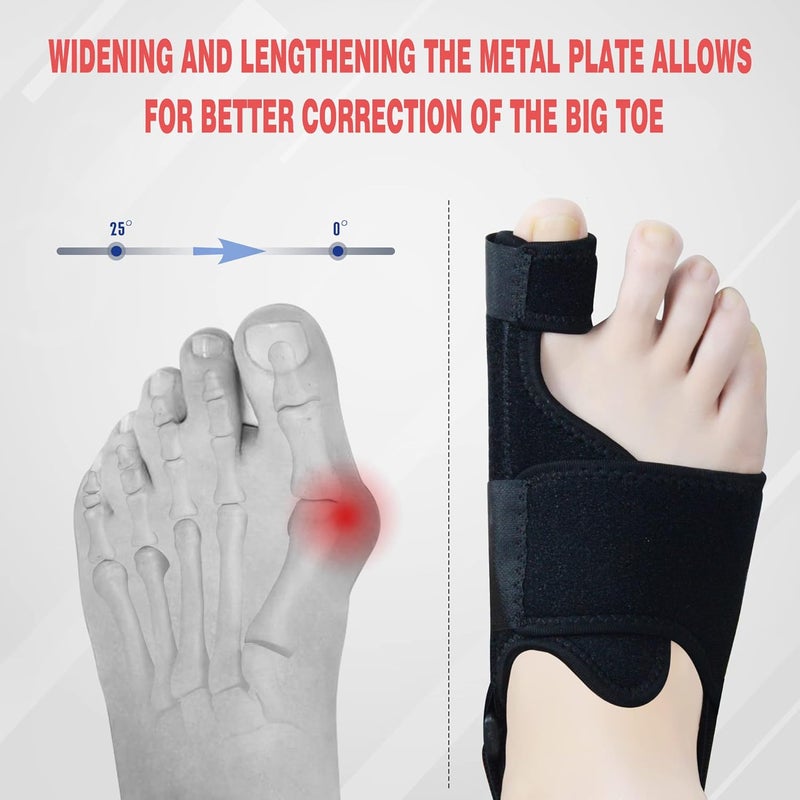 Day and night toe braces, unisex thumb valgus correction belt, foot support pain reliever - Image 5