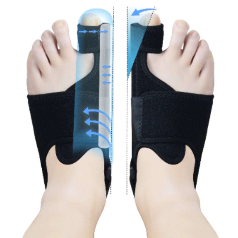 Day and night toe braces, unisex thumb valgus correction belt, foot support pain reliever - Image 1