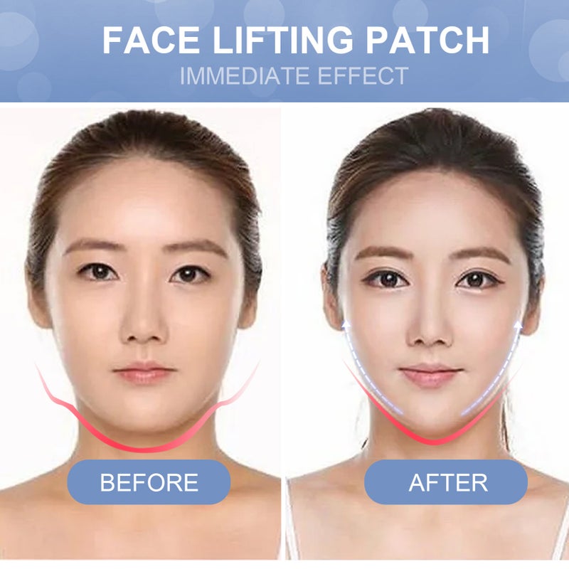 EELHOE 40Pcs Face Lifting Patches Adhesive Tapes Face Neck Lift Elastic Waterproof Shape Slim Firm Face - Image 3