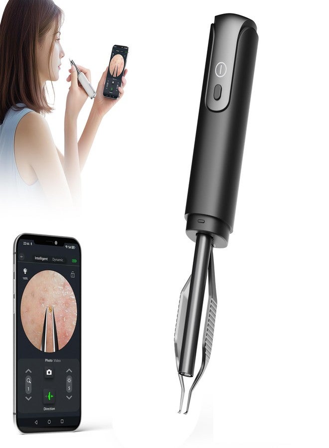 scopepick Blackhead Removal Tweezer with 1080p Camera, Ultimate Precision: Blackhead Removal with Camera - Perfect for Delicate Tasks! - - Ingrown Hair, Ear Hair Tweezer (Black) - Image 1