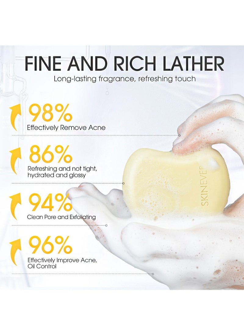 Salicylic Acid Soap，with Kojic Acid，Sulphur，Aloe Vera for Pore Exfoliating，Softening Skin，Anti-Blemish，Skin Cleansing，purify pores，Exfoliating (80g)