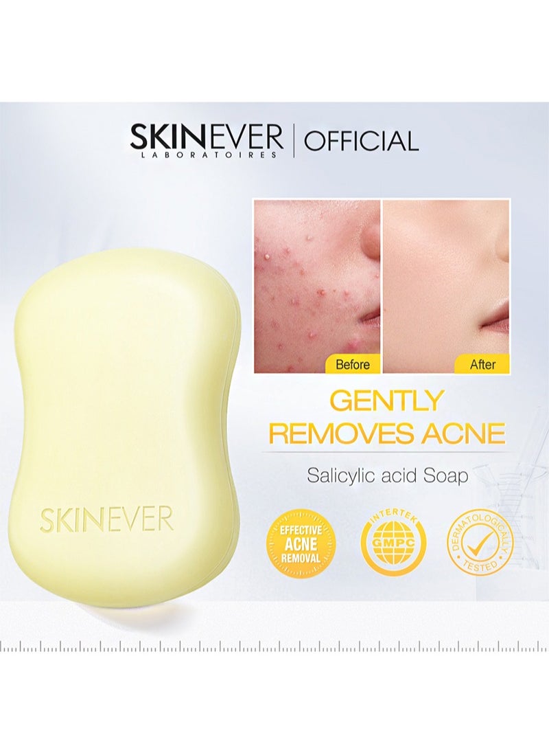 Salicylic Acid Soap，with Kojic Acid，Sulphur，Aloe Vera for Pore Exfoliating，Softening Skin，Anti-Blemish，Skin Cleansing，purify pores，Exfoliating (80g)
