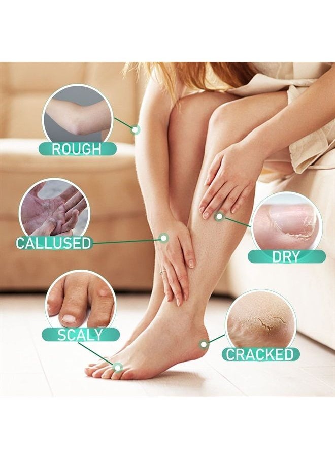 AirroYE - Urea 40% Foot Cream with 2% Plus Salicylic Acid， Foot Cream for Dry Cracked Heels - best Callus Remover For Feet & Hands, Natural Moisturizes Nourishes Softens Dry, Rough, Cracked, Dead Skin - Image 1
