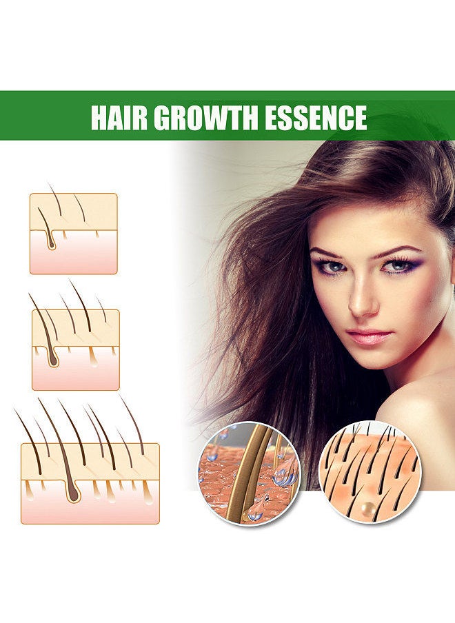 EELHOE - EELHOE Hair Growth Essence Liquids Oils Scalp Nutritious Repairs Hair Growth Hair Caring 30ml/Bottle - Image 1