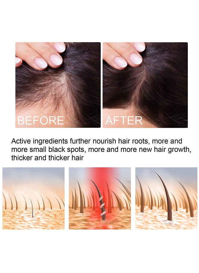 EELHOE - EELHOE Hair Growth Essence Liquids Oils Scalp Nutritious Repairs Hair Growth Hair Caring 30ml/Bottle - Image 1