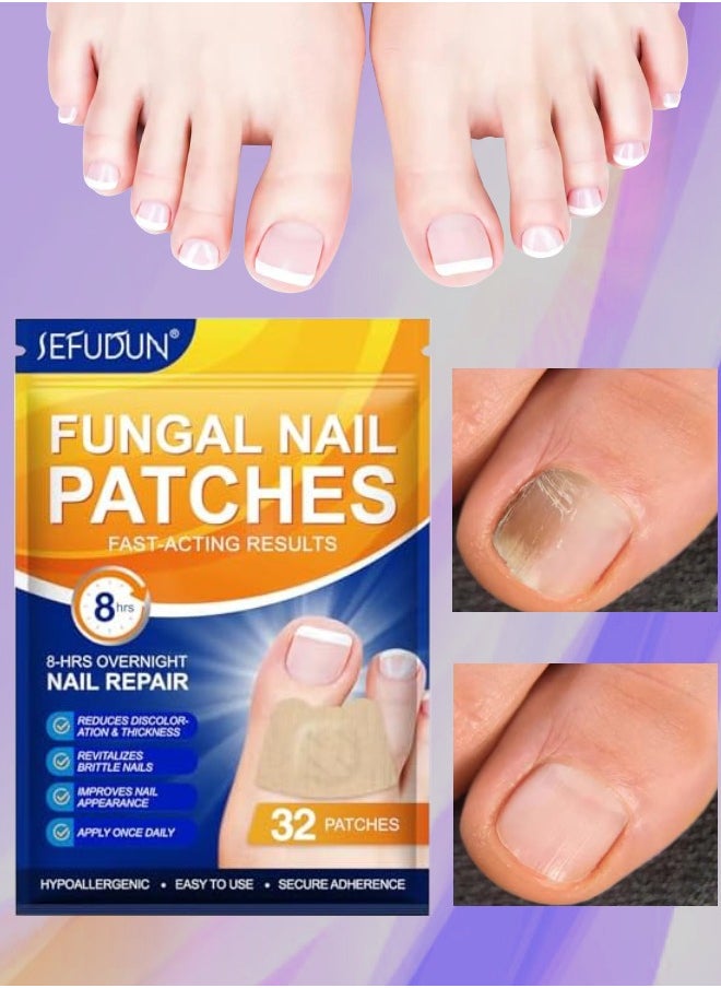 32Pcs Fungal Nail Patches Overnight Nail Repair Patch for Nail Fungus Damage Nail Treatment Renews Nails Structure and Improve Discoloration 8Hrs Nighttime Renewal Fungal Nail Patch - pzsku/Z9D55AC27C70EA05911A6Z/45/_/1721295064/14f418fe-696e-4731-b19e-4eb5db55ea50