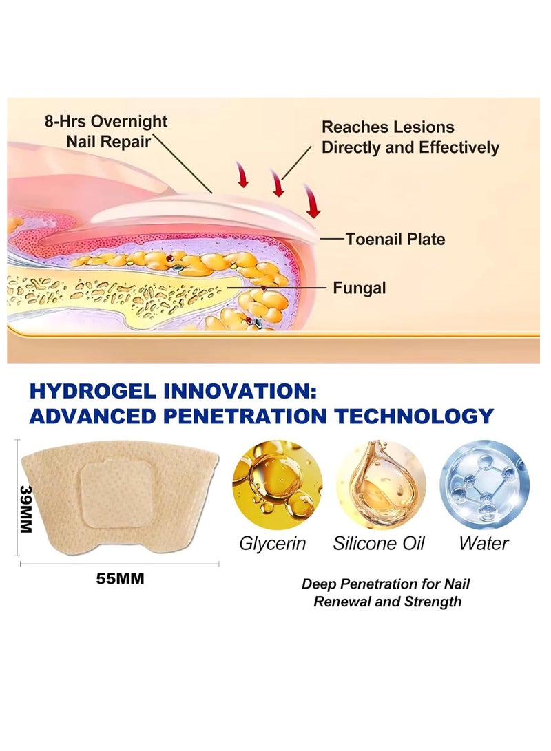 Sefudun 32 قطعة لاصقات أظافر فطرية لاصقة إصلاح الأظافر الليلية لعلاج تلف الأظافر الناتج عن الفطريات تجديد هيكل الأظافر وتحسين تغير اللون 8 ساعات تجديد ليلي لاصقة الأظافر الفطرية - Image 2