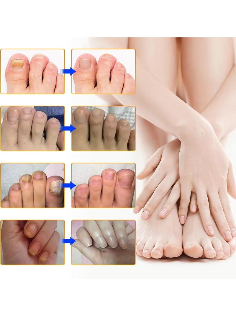 Sefudun 32 قطعة لاصقات أظافر فطرية لاصقة إصلاح الأظافر الليلية لعلاج تلف الأظافر الناتج عن الفطريات تجديد هيكل الأظافر وتحسين تغير اللون 8 ساعات تجديد ليلي لاصقة الأظافر الفطرية - Image 5