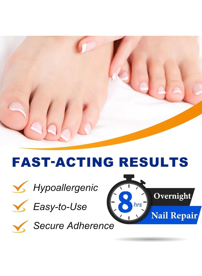 32Pcs Fungal Nail Patches Overnight Nail Repair Patch for Nail Fungus Damage Nail Treatment Renews Nails Structure and Improve Discoloration 8Hrs Nighttime Renewal Fungal Nail Patch - pzsku/Z9D55AC27C70EA05911A6Z/45/_/1721295168/56e712be-3034-4753-a18b-6a7a0c6ca2b1