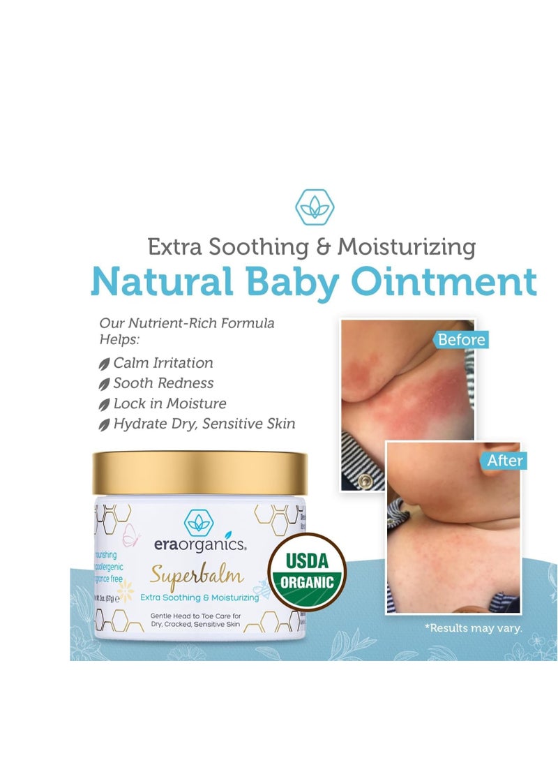 Era Organics - Era Organics Healing Ointment for Babies - USDA Certified Organic Natural Gentle Moisturizer for Sensitive Skin Prone To Baby Eczema, Cradle Cap (Infant Seborrheic Dermatitis), Rashes, Hives & More - Image 1