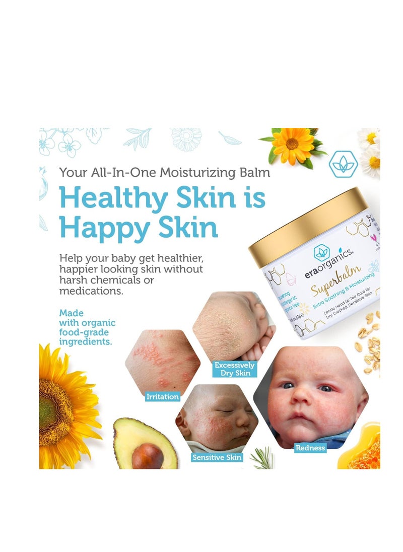 Era Organics - Era Organics Healing Ointment for Babies - USDA Certified Organic Natural Gentle Moisturizer for Sensitive Skin Prone To Baby Eczema, Cradle Cap (Infant Seborrheic Dermatitis), Rashes, Hives & More - Image 1