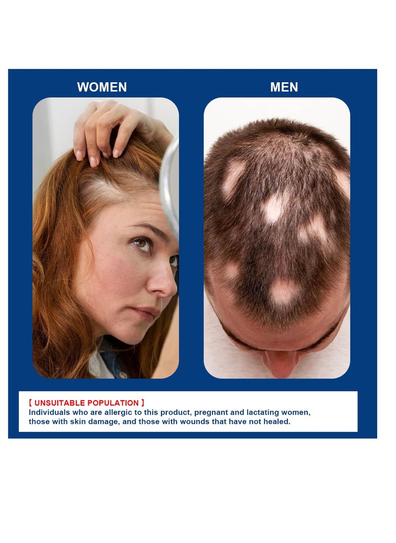 Sumifun - 20g Alopecia Hair Growth Cream for Promote Men's Hair Growth,Prevent Hair Loss,Care for Hair - Image 1