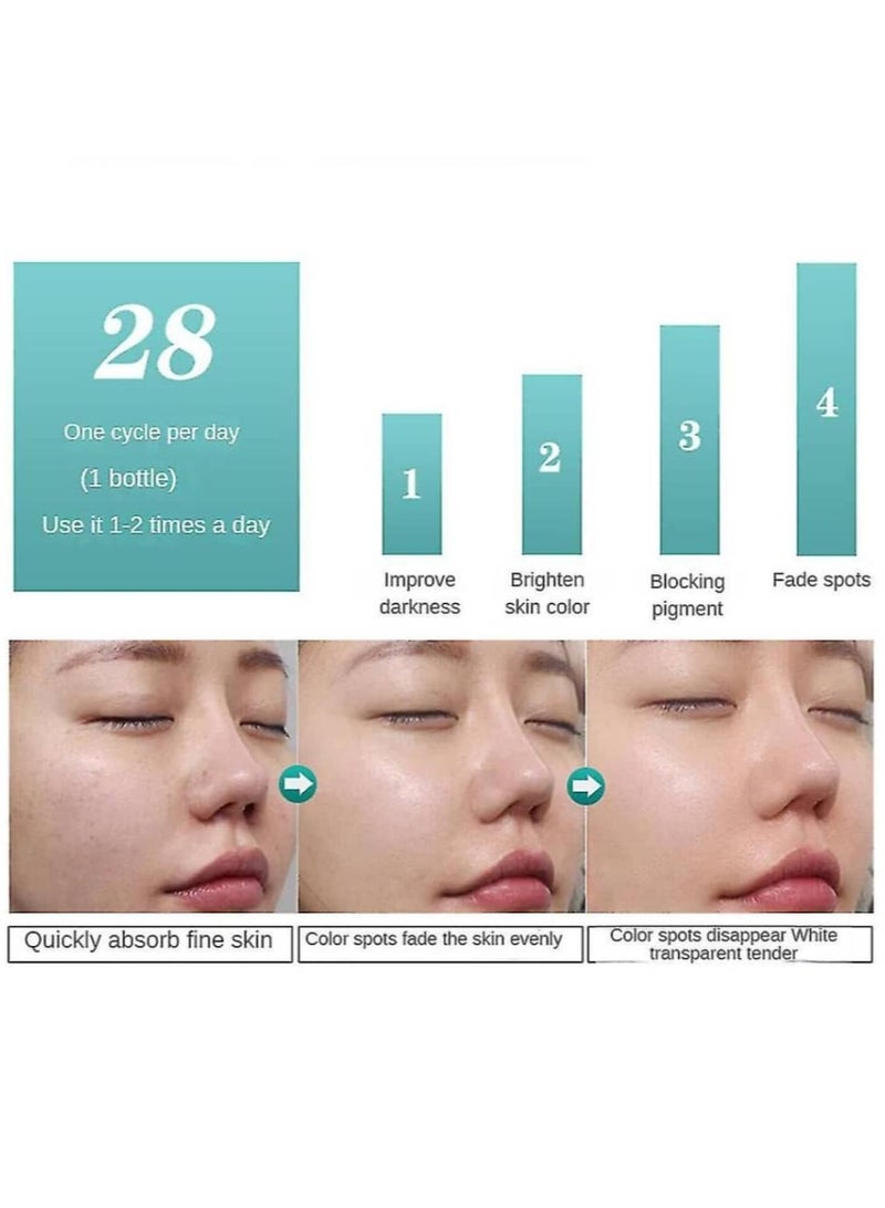 Hancy Freckle whitening cream blackheads, melasma remover, pigmentation lightening, skin moisturizing - Image 3